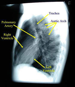 Cours - Pneumologie - Aide à la lecture d'une radiographie de ...